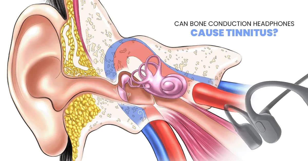 Can Bone Conduction Headphones Cause Tinnitus?